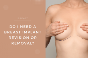 do i need a breast revision or removal